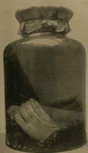 Pickled Hands Hand of Glory